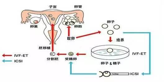 泰国试管婴儿